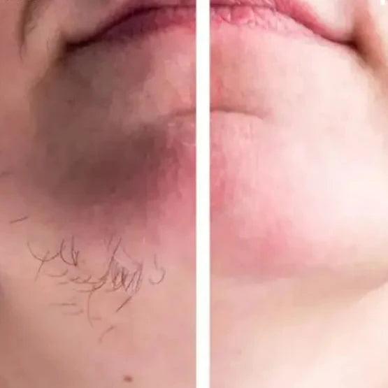 Caneta Depiladora Sobrancelha / Facial (Leve 2 e Poupe 60%)