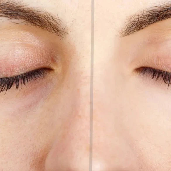 Caneta Depiladora Sobrancelha / Facial (Leve 2 e Poupe 60%)