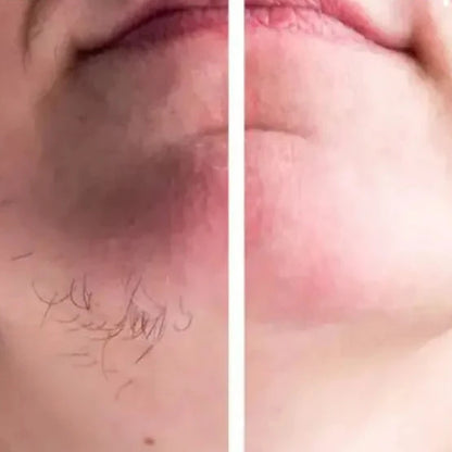 Caneta Depiladora Sobrancelha / Facial (Leve 2 e Poupe 60%)